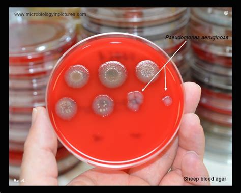 Identifying Pseudomonas Aeruginosa on Blood Agar.